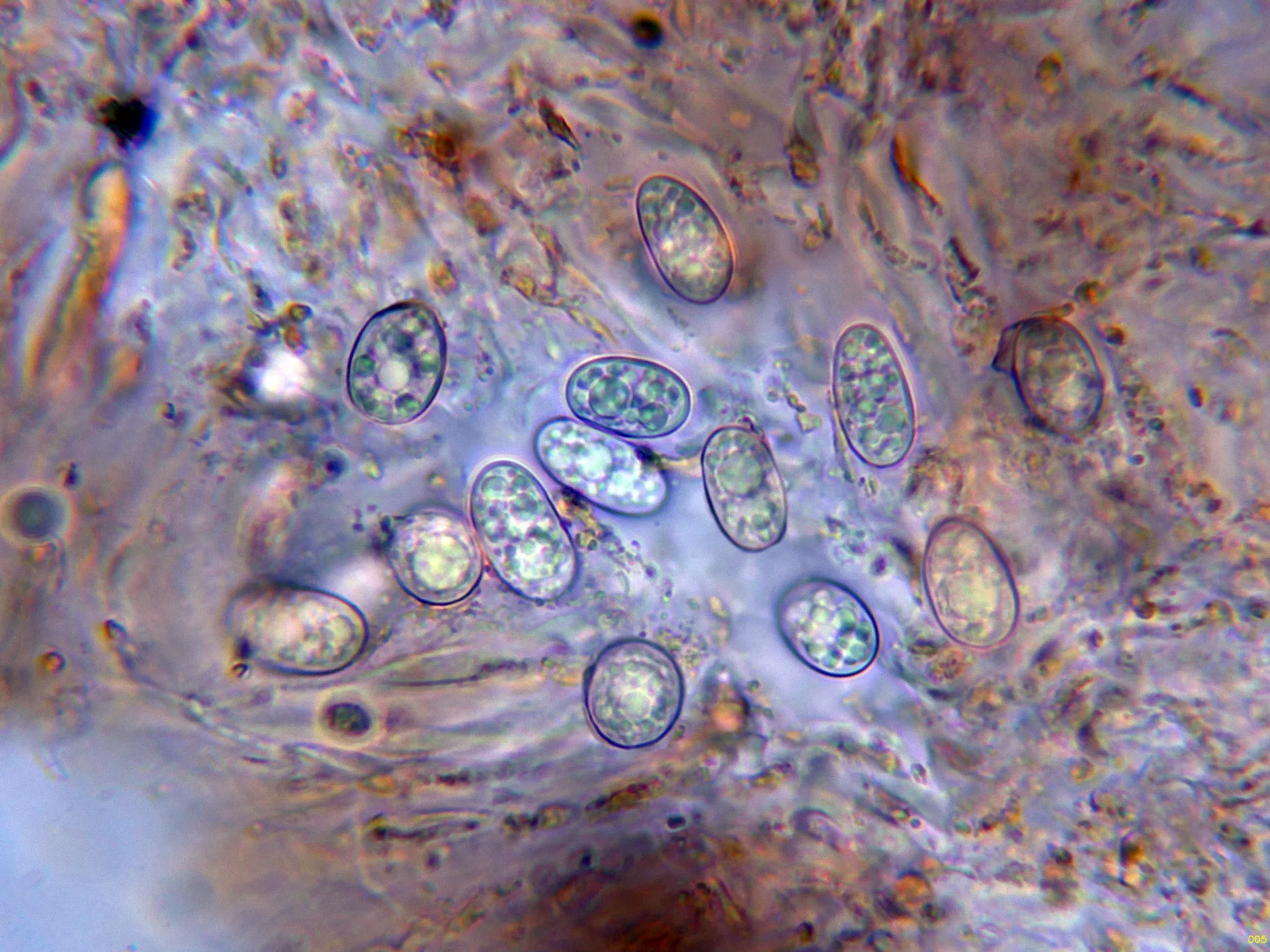 Microscopía de Parmelina quercina - 10 - Esporas